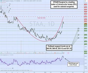 Star Surgical Shines as U.S. Outlook Improves for 2024: https://www.marketbeat.com/logos/articles/med_20240414163830_chart-staa.jpg