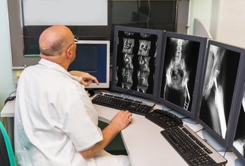Why Shares of Apollomics Are Up Friday: https://g.foolcdn.com/editorial/images/734900/radiologist-of-oncology-institute-is-examing-mri-scans.jpg