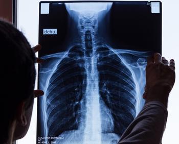 Why Alphatec Holdings Stock Plunged Today: https://g.foolcdn.com/editorial/images/752289/doctor-checking-on-chest-x-ray.jpg